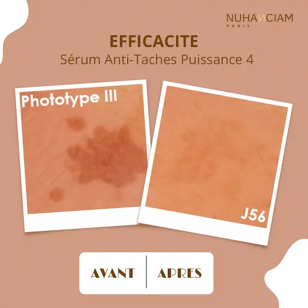 sérum anti taches puissance 4 nuhanciam sérum anti taches puissance 4 nuhanciam